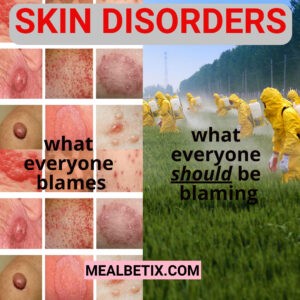 SKIN DISORDERS Autoimmune